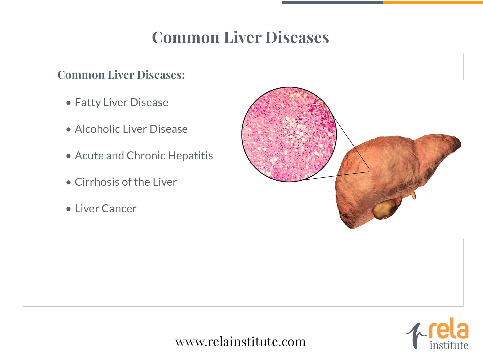 Liver Disease Treatment in Chennai | Dr. Rela Institute & Medical