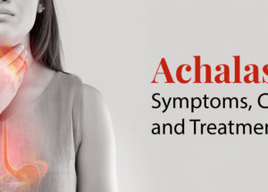 Achalasia: Symptoms, causes, and treatment