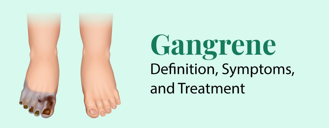 Gangrene – Definition, Symptoms, and Treatment