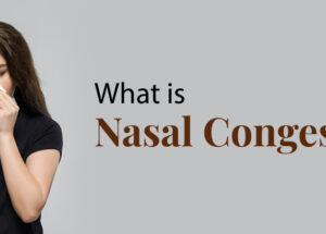 What is nasal congestion?
