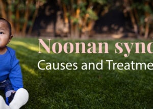 Noonan Syndrome: Causes and Treatment