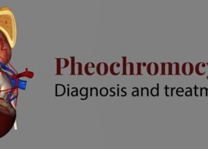 Pheochromocytoma- Diagnosis and Treatment